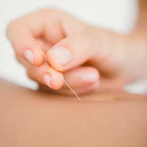 Acupuncture and massage.